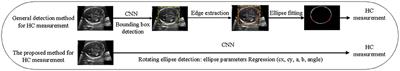 RDHCformer: Fusing ResDCN and Transformers for Fetal Head Circumference Automatic Measurement in 2D Ultrasound Images